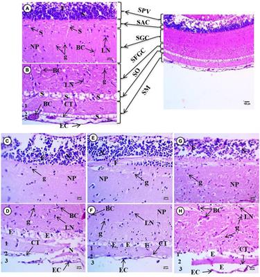 Neurotoxic effects of different sizes of plastics (nano, micro, and macro) on juvenile common carp (Cyprinus carpio)